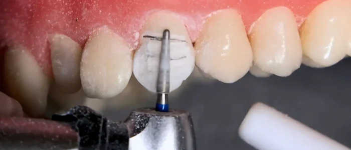 Design sem nome (13)